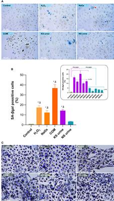 Premature Senescence and Telomere Shortening Induced by Oxidative Stress From Oxalate, Calcium Oxalate Monohydrate, and Urine From Patients With Calcium Oxalate Nephrolithiasis